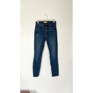 Madewell 11” High-Rise Skinny Jeans: Button-Front Edition | 25P